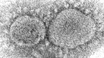 A view of Sars-CoV-2 virus particles, which cause Covid-19. AP