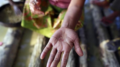 A woman shows rubies she found at a marble mine at Zagyin village in the Madaya township. Soe Zeya Tun / Reuters