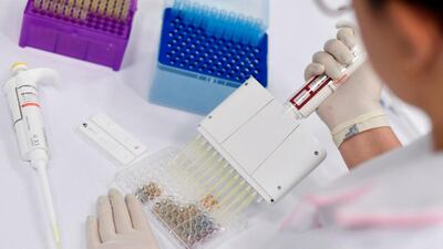 Last June, ADSCC announced the results of the trial of its treatment for Covid-19 patients, branded UAECell19. AFP