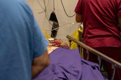 Doctors treat a man wounded in an Israeli strike, at the Nabih Berri government hospital in Nabatieh. Matt Kynaston for The National.