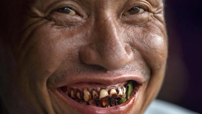 A habitual “kun-ya” eater with some betel leaves in his mouth smiles in Yangon, Myanmar. Chewing “kun-ya”is vital to life in Myanmar. Gemunu Amarasinghe / AP