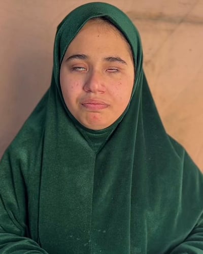 Zein Al Dalu, 16, has required treatment for her eyes since birth, including operations