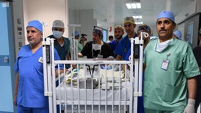 A team of 35, including surgeons, doctors, technicians and nurses, successfully separated the twins at King Abdullah Specialist Children's Hospital in Riyadh, the Saudi Press Agency said on Thursday.