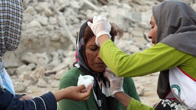 An Iranian woman receives medical treatment from aid workers. AFP PHOTO / MOHAMMAD FATEMI