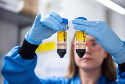 A researcher in a laboratory at the Jenner Institute in Oxford, England, works on the coronavirus vaccine developed by AstraZeneca and the University of Oxford. Courtesy: University of Oxford / John Cairns via AP