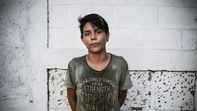 Christopher Rodriguez, 13, poses as he plays football in a neighbourhood of Managua, on January 13, 2016. Football is gaining enthusiasts in Nicaragua where baseball has been historically dominant but is now giving way to the new sport, analysts said. Inti Ocon / AFP