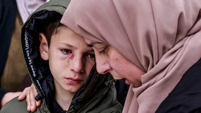 Eight-year-old Mustafa was injured in the Israeli attack that killed his parents and two of his siblings. AFP