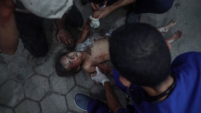 Injured Palestinians, including children, are brought to Al Ahly Hospital after Israeli air strikes attacked civilians in Gaza city's Zeitoun neighbourhood on July 22