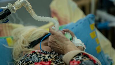A patient with coronavirus breathes with the help of an oxygen mask at an intensive care unit in the regional hospital in Chernivtsi, western Ukraine. AP Photo