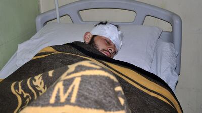 A wounded Syrian pro-regime fighter is pictured in a hospital in Syria's eastern city of Deir Ezzor on February 8, 2018. More than 200 private Russian military contractors fighting on behalf of the regime were killed by US forces in Syria last week. Stringer / AFP