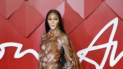 Canadian model Winnie Harlow. EPA