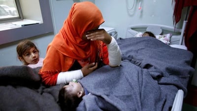 A mother weeps as her daughter Ranmea is treated for possible exposure to chemical weapons agents in a hospital west of Mosul, Iraq, March 4, 2017. Azad Lashkari / Reuters