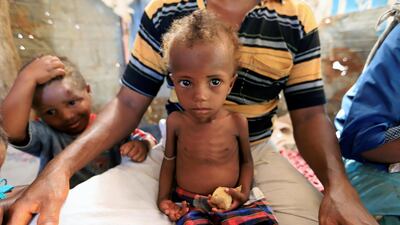 Hanaa Ahmad Ali Bahr, a malnourished girl sits on her father's lap in a shanty town in Hodeidah, Yemen March 25, 2019. Reuters