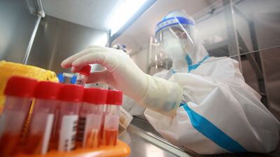 A laboratory technician prepares samples to be tested for Covid-19 at a testing centre in Yangzhou, China.