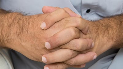 The hands of an expatriate from Syria who required dialysis. Christopher Pike / The National