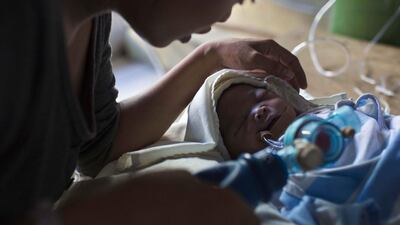 Genia Mae Mustacisa pumps oxygen into the lungs of three-day-old Althea at the altar of a Catholic chapel in the Eastern Visayas Regional Medical Centre in Tacloban. David Guttenfelder / AP