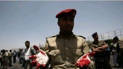 A Yemeni police officer shows his bloodied hands after collecting evidence following a suicide attack on a military parade killed at least 96 in Sanaa today.
