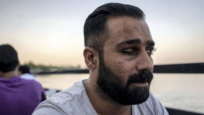 Haider Hasan Alwan, a protester who got hit with a tear gas canister in the eye. Haider Husseini for The National