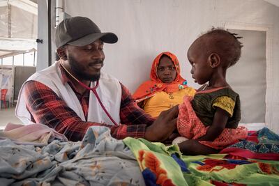 A Sudanese child suffering from malnutrition is examined at an MSF clinic in Metche Camp, Chad, near the Sudanese border. AP