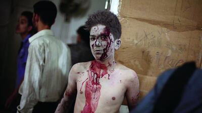 An injured boy looks on as he is being treated at a makeshift hospital in the besieged rebel bastion of Douma, northeast of the Syrian capital Damascus, on September 24, following reported airstrikes by government forces. Some 191,000 people have been killed since an uprising against President Bashar Al Assad’s rule erupted in March 2011. Abd Doumany / AFP
