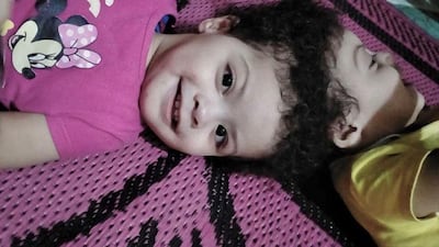 Egyptian conjoined twins Sarah and Salma will travel to Riyadh ahead of possible separation surgery. SPA