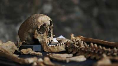 “It’s fantastic we can look in such detail at an individual who died 600 years ago,” Dr Walker said. “It’s incredible, really.”