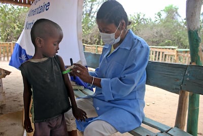 A child is treated for severe malnutrition at a centre set up by the United Nations World Food Programme and Action Against Hunger, in the village of Beraketa, south of Madagascar, November 12. AP