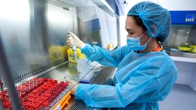 A lab technician at the Reagent Preparation Area of the laboratory.