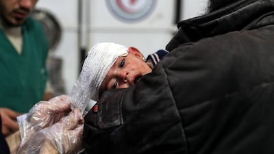 An injured nine-month-old girl receives medical attention at a field hospital after bombing attacks on rebel-held Douma, in the Damascus suburb of Eastern Ghouta, on November 26, 2017. Mohammed Badra / EPA