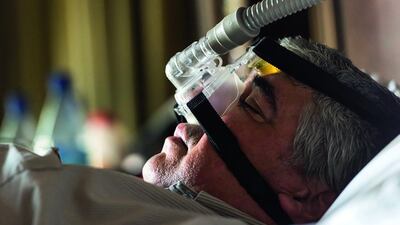 One of the common treatments for sleep apnea is use of a machine that delivers air through a mask placed over the nose. Getty Images