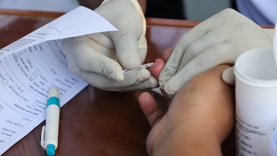 The new blood test could be used to detect cancer earlier. EPA