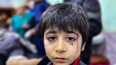 An injured child awaits treatment at Bab Al Hawa hospital. AFP
