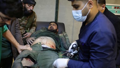 An man is treated at the Al Rashid Hospital after being injured in fighting between Syrian government forces and Kurdish fighters in Raqqa. AFP