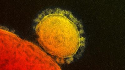 An electron microscope image by the National Institute of Allergy and Infections Diseases – Rocky Mountain Laboratories shows a coronavirus particle, also known as the Mers virus, centre. AP Photo