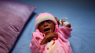 A malnourished boy lies on in an intensive care unit in the Red Sea port city of Houdeidah, Yemen on November 17, 2016. The country is on the brink of famine after a protracted civil war. Khaled Abdullah / Reuters