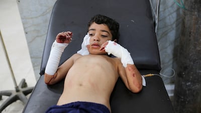 An injured Palestinian boy in hospital after the strike on Nuseirat refugee camp in Gaza. Reuters