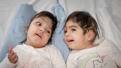 Safa and Marwa Ullah from Charsadda in Pakistan, post separation. Patricia McHugh