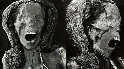 A scan of the famous 'Screaming Woman' mummy, excavated in Egypt in the 1930s. The mummy was the subject of a report conducted by specialists at Cairo University's Kasr Al Ainy Hospital. Photo: Frontiers in Medicine