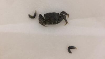 Doctors said the critter was live when it came out of the ear canel. Courtesy: Burjeel