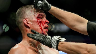 Nate Diaz has blood washed off his face during his UFC 244 bout against Jorge Masvidal. AFP