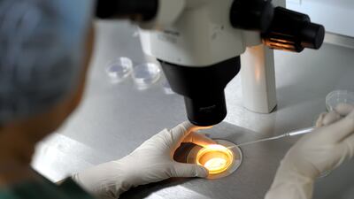 US fertility scientists have created a technique whereby sperm can be chosen that boosts the odds of conceiving specifically a boy or girl. Photo: UEMedical