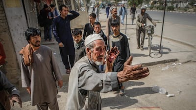 epa07760002 A man who was injured in a car bomb blast talks to people at the scene, in Kabul, Afghanistan, 07 August 2019. Dozens of people were injured when a car bomb exploded outside a police station in Kabul. EPA/HEDAYATULLAH AMID