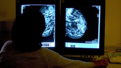About four in 10 cancer cases are preventable, a cancer charity has said. PA