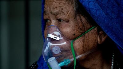 A Covid-19 patient is being treated outside of a hospital in Kathmandu, Nepal. EPA