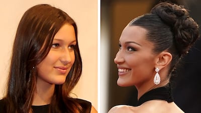 Bella Hadid in 2010, left, and in 2021. The model has revealed she underwent a rhinoplasty procedure at the age of 14, after saying she was upset at being Gigi's 'uglier sister'. Getty Images, AP