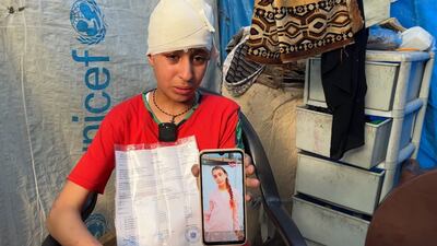 Gaza girl hopes for treatment after losing hair to air strike burns