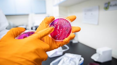 A laboratory technician at the Abu Dhabi Quality and Conformity Council shows cultures growing in a petri dish.
