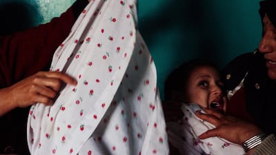 Nine-year-old Alia cries as her bandages are changed after she was burned during the explosion. Ivan Flores for The National