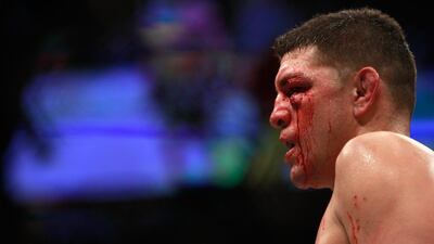 Nick Diaz shown bloodied in the Octagon after taking a hit from Anderson Silva during their middleweight fight at UFC 183 on Saturday. Steve Marcus / Getty Images / AFP