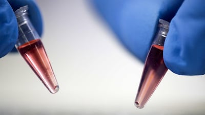 A view of flasks with laboratory samples in San Jose, Costa Rica, as Costa Rican scientists develop a saliva test to quickly detect Covid-19. EPA